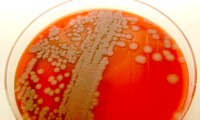 Bacillus anthracis